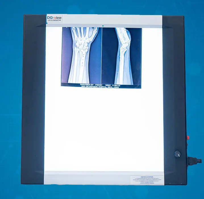 X-Ray View Box