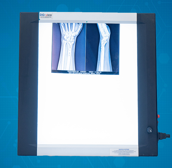 X-Ray View Box